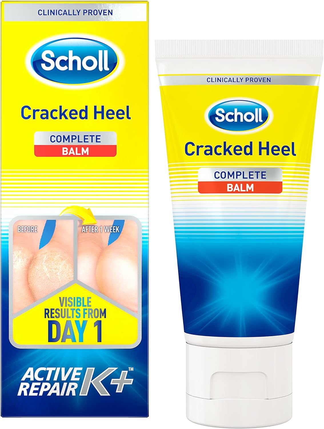 Best Cream for Cracked Heels: Top Solutions for Smooth Feet